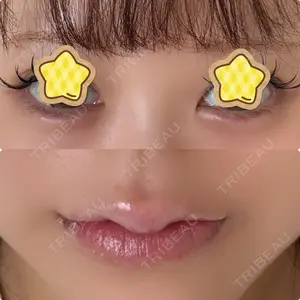 渋谷美容外科クリニック 渋谷美容外科クリニック 新宿院口コミ