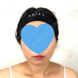 アリエル美容クリニック アリエル美容クリニック 横浜院口コミ