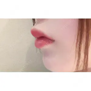 PRO CLINIC プロクリニック 銀座院口コミ