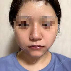 口コミ