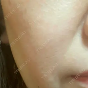 APスキンクリニック銀座口コミ