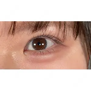 口コミ