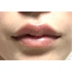 口コミ