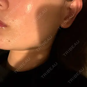 口コミ