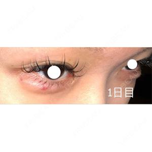 口コミ