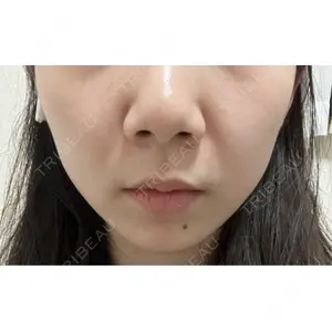 ルラ美容クリニック ルラ美容クリニック 町田院口コミ