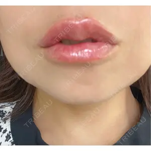 口コミ