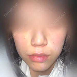 CZEN CLINIC 銀座院口コミ
