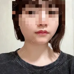 口コミ