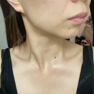 TCB東京中央美容外科 TCB東京中央美容外科 大宮東口院口コミ