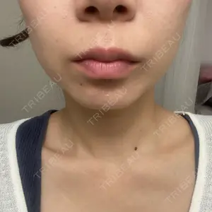 TCB東京中央美容外科 TCB東京中央美容外科 大宮東口院口コミ