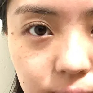 A CLINIC（エークリニック） A CLINIC（エークリニック） 福岡院口コミ