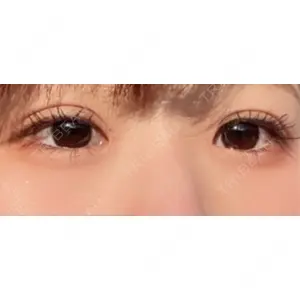 口コミ