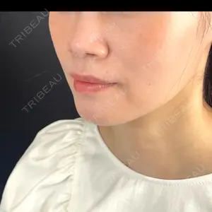 口コミ