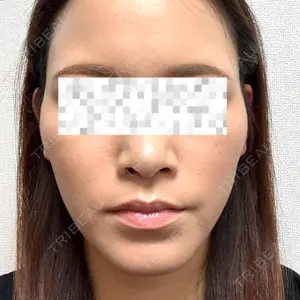 HAAB×DREAM BEAUTY CLINIC HAAB×DREAM BEAUTY CLINIC 東京本院口コミ