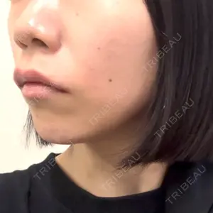 EMMO FACE CLINIC EMMO FACE CLINIC 大宮院口コミ
