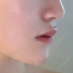 口コミ