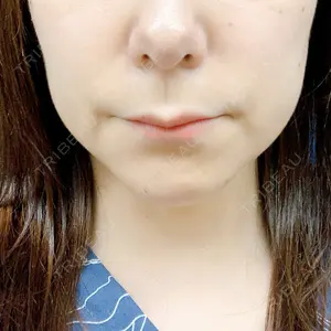 口コミ