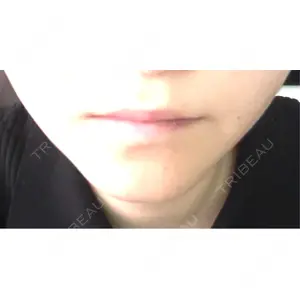 PRISM Beauty Clinic  PRISM Beauty Clinic 町田院口コミ