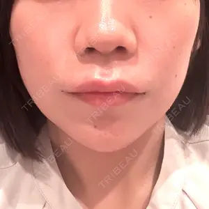 EMMO FACE CLINIC EMMO FACE CLINIC 大宮院口コミ