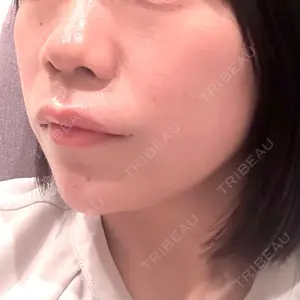 EMMO FACE CLINIC EMMO FACE CLINIC 大宮院口コミ