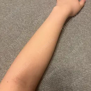 グリシーヌクリニック口コミ