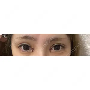 PRO CLINIC プロクリニック 銀座院口コミ