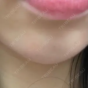 プロクリニック PRO CLINIC プロクリニック 銀座院口コミ