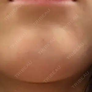 プロクリニック PRO CLINIC プロクリニック 銀座院口コミ