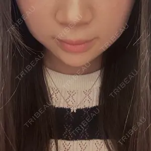 口コミ