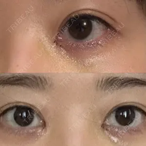 口コミ