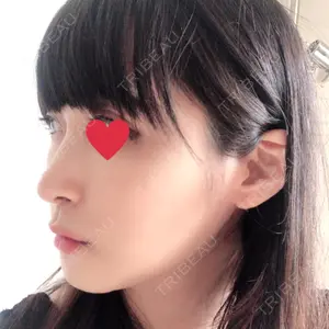 RG整形外科（旧リオン整形外科）口コミ