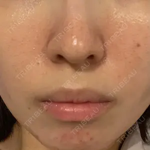 Fellez Clinic【フェルズクリニック】口コミ