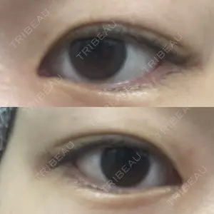 9BeautyClinic口コミ