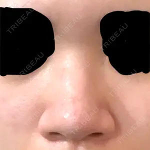 ロレシー美容クリニック 心斎橋駅前院口コミ