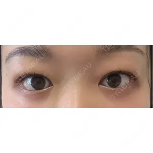 湘南美容クリニック 池袋東口院の