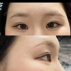 LUHO（ルホ）美容外科口コミ