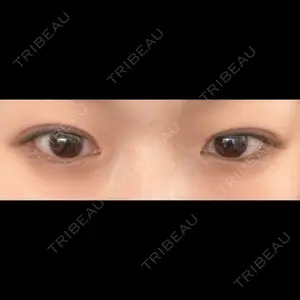 LUHO（ルホ）美容外科口コミ