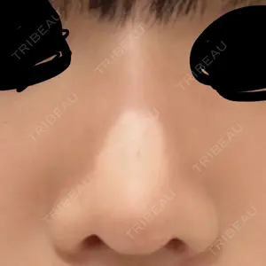 LUHO（ルホ）美容外科の