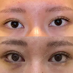 LOUIS CLINIC 二子玉川院【ルイクリニック】口コミ