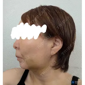 口コミ