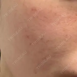 MIO CLINIC 梅田院口コミ