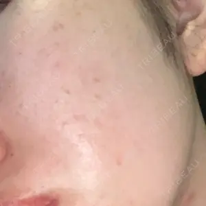 MIO CLINIC 梅田院口コミ