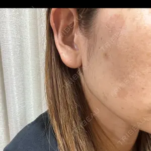 APスキンクリニック銀座口コミ