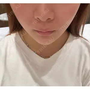 HAAB×DREAM BEAUTY CLINIC HAAB×DREAM BEAUTY CLINIC 大阪梅田院口コミ