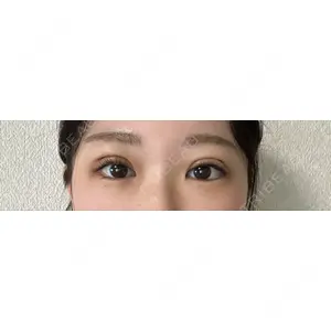 湘南美容クリニック 湘南美容クリニック 池袋東口院口コミ