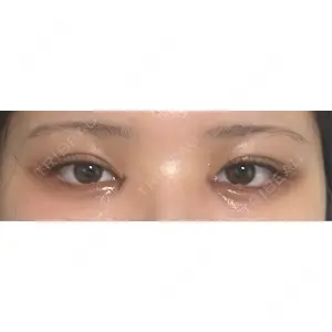 HAAB×DREAM BEAUTY CLINIC HAAB×DREAM BEAUTY CLINIC 大阪梅田院口コミ