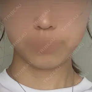 口コミ