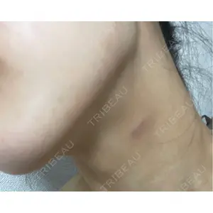 A CLINIC（エークリニック） A CLINIC（エークリニック） 福岡院口コミ