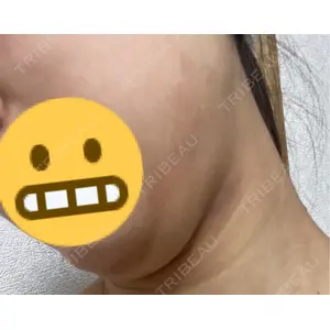 A CLINIC（エークリニック） A CLINIC（エークリニック） 福岡院口コミ
